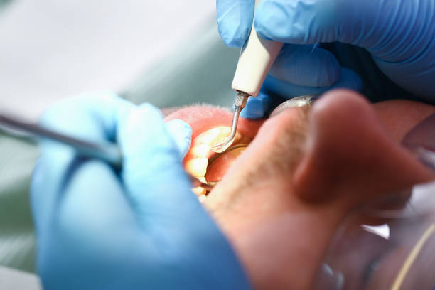 Best Emergency Treatment for Toothache in Parsippany, NJ