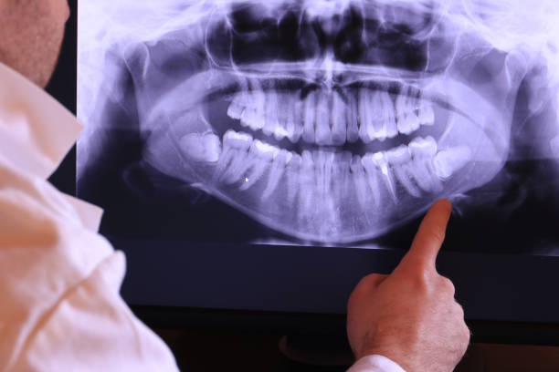 Best Emergency Treatment for Toothache in Parsippany, NJ