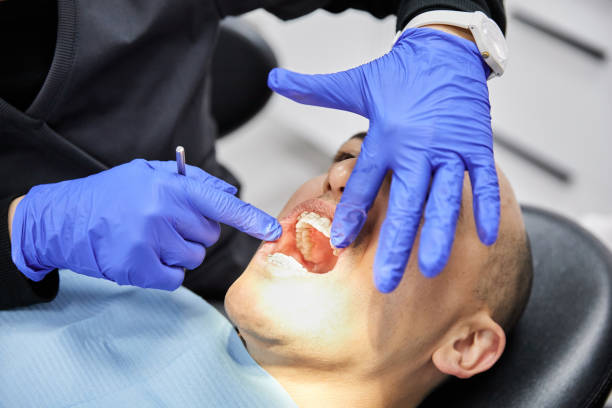 Best Emergency Treatment for Toothache in Parsippany, NJ